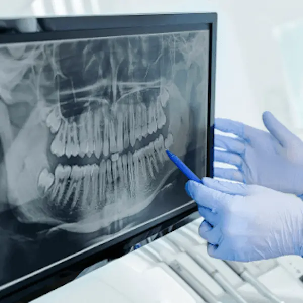 Dantų rentgeno nuotraukos
